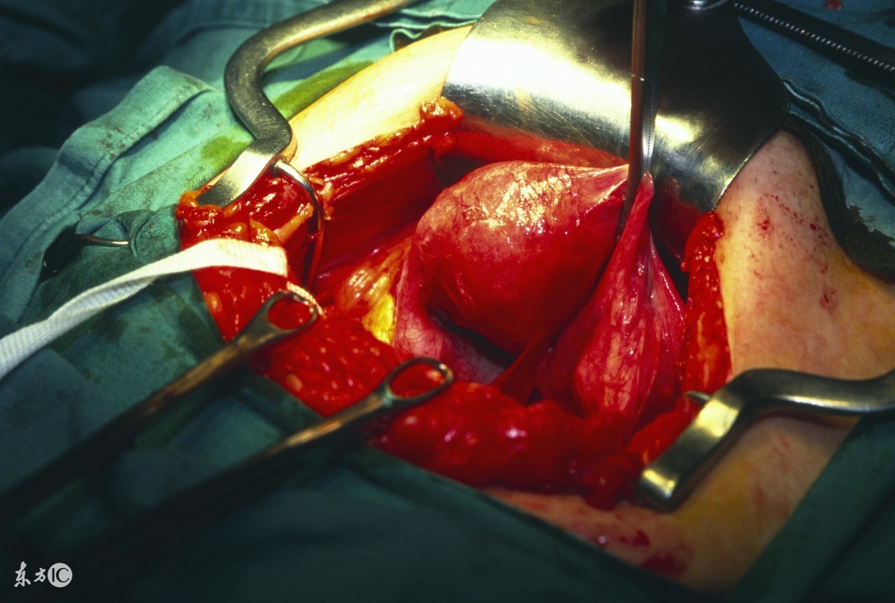 25岁妈妈生下女儿1个月后，下面掉出“一块肉”，医生怒骂老公！