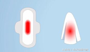 如何照顾剖宫产的孕妇,如何护理顺产妈妈