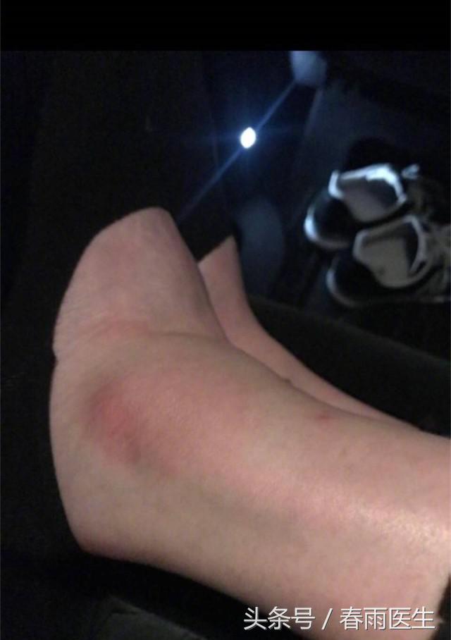 奚梦瑶维密秀摔倒是哪一年,奚梦瑶摔倒对维密秀的影响