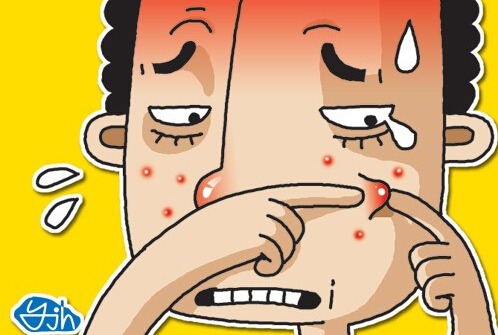 13岁男孩挤鼻腔痘痘引发脑膜炎,小伙挤痘痘得了罕见怪病
