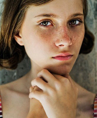 各种斑的特点区别,16种斑如何分析鉴别