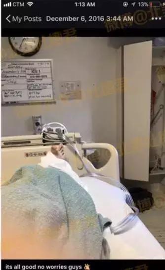 没有头骨的女孩,没有头骨活下来的女孩