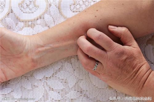 三甲医院通用的《疾病先兆自查表》，我用了几十年，现在还在用！