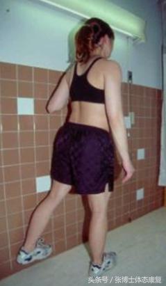 孕期耻骨痛怎么训练恢复,孕期耻骨疼怎么锻炼