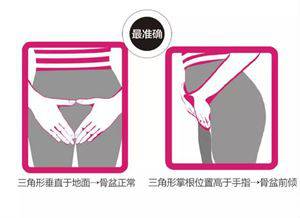 你的屁屁是真的蜜桃臀？还是骨盆前倾的伪翘臀？