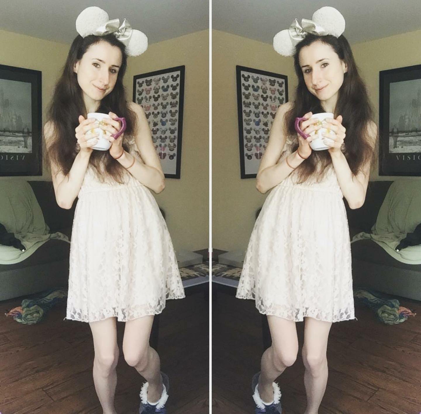 厌食症应该怎么缓解,对厌食症患者怎么心理指导