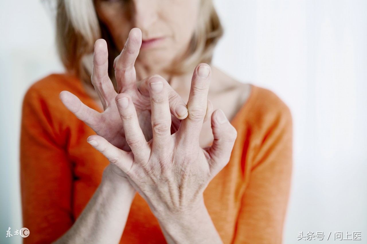 类风湿关节炎累及眼睛怎么治疗,类风湿性关节炎与眼部的并发症