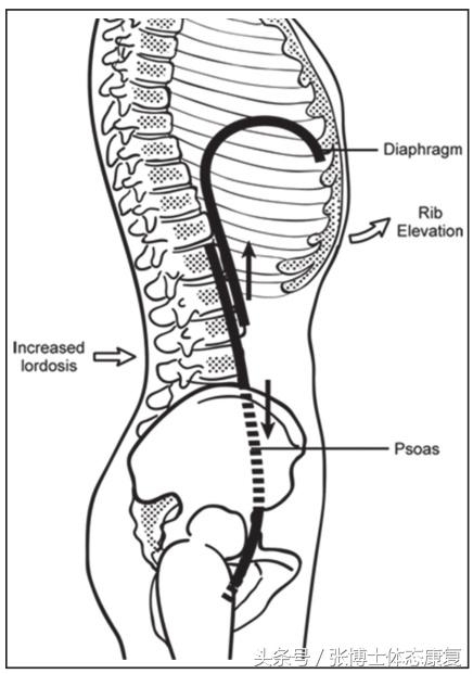 译文分享｜关于90/90臀桥吹气球训练的原理、价值与应用研究