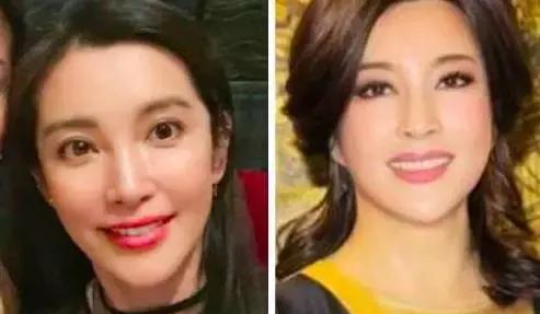 假体隆鼻都有什么术式,假体隆鼻一般用什么材料