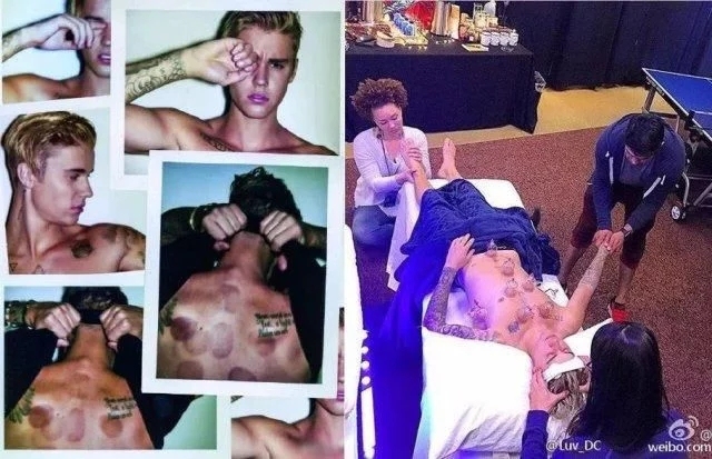 让众多明星痴迷的神秘东方医术！快来get明星同款！