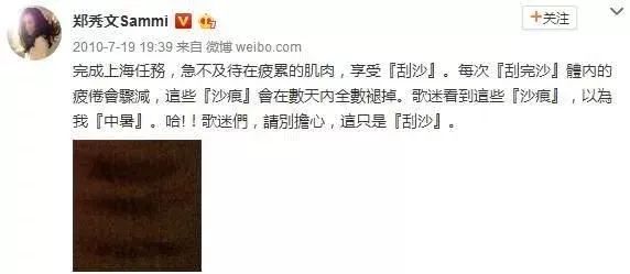 让众多明星痴迷的神秘东方医术！快来get明星同款！