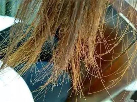 冬天上火怎样降火吃什么药,冬天上火食疗方法