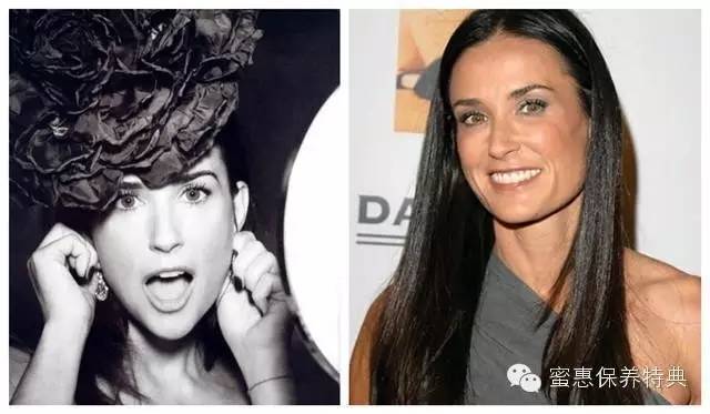 欧美阿姨PK日本大妈——差了10斤胶原蛋白！