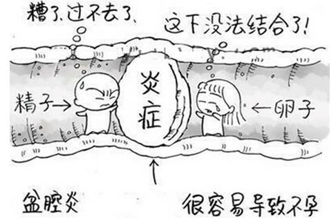 女性盆腔炎导致下腹哪个部位疼痛,盆腔炎为什么会导致下腹疼痛