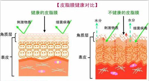怎样改善面部红血丝肤质,脸部红血丝怎么修复医美