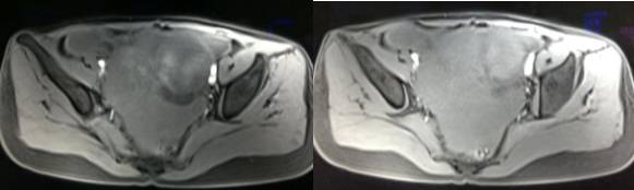女性下腹疼痛是什么病,女性下腹疼痛的预兆