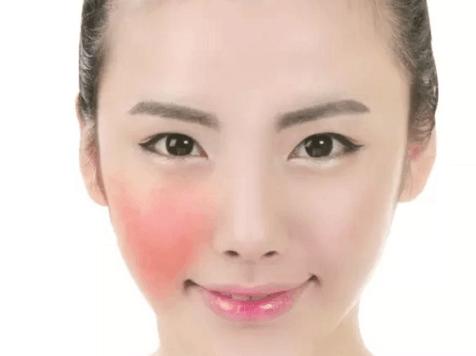 去除红血丝的精华,去除红血丝用什么护肤品