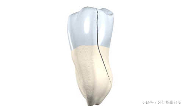 用了舒客牙膏牙齿对冷热敏感,牙齿敏感松动用什么牙膏最好