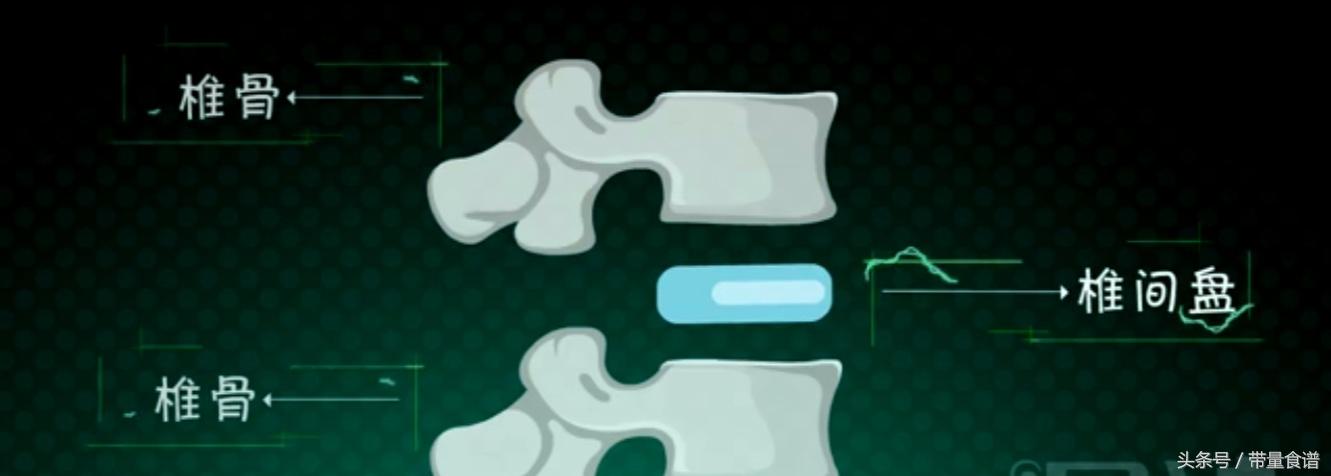 坐不久就腰痛怎么回事,坐着的时候腰椎间盘突出