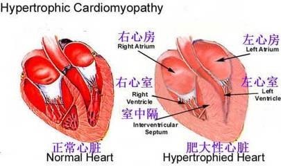让房颤快而乱的心跳慢下来、跳整齐，用什么药？