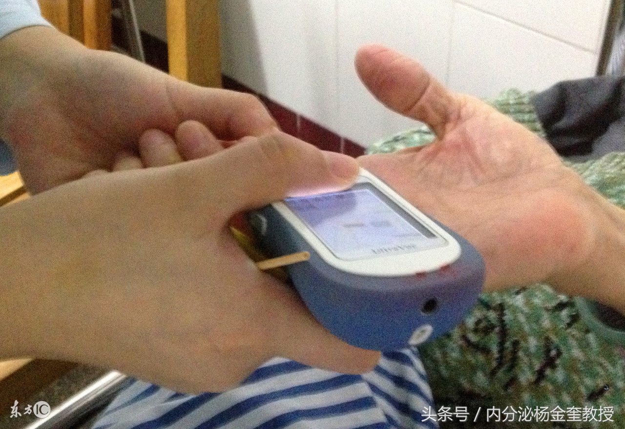 测血糖的注意事项孕妇,空腹测血糖饮食注意