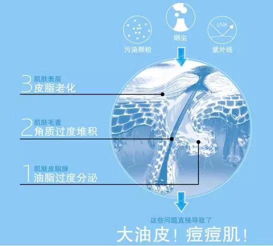 痘痘类皮肤的护理方法有哪些,痘痘肌肤的8个护理方式
