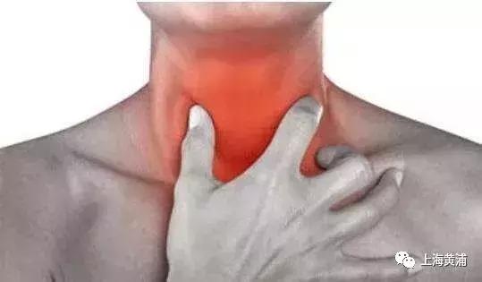 季节性慢性咽喉炎怎么治,季节交替导致咽炎怎么治疗