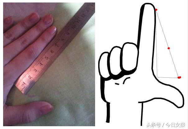 太尴尬了!她产后去医院做盆底筛查,医生却拿出一把小钢尺……
