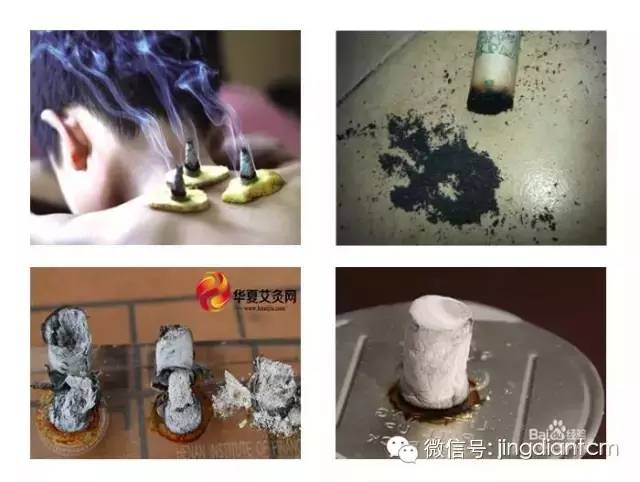 中医名家艾灸视频全集,中医艾灸知识100例