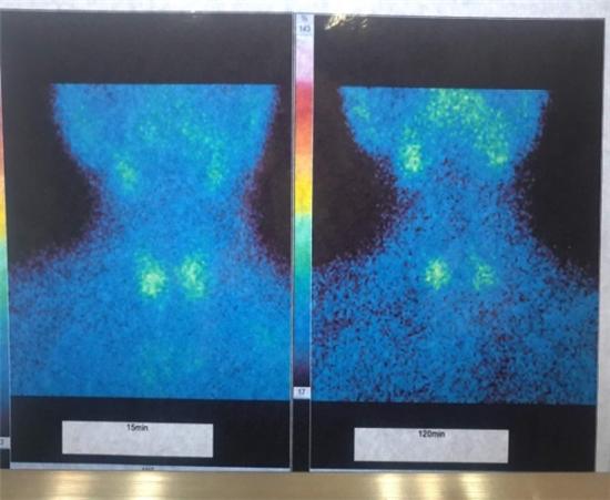 病理性骨折的常见病因,病理常见知识点