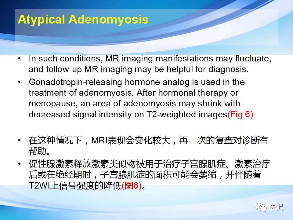 双语PPT：子宫腺肌症常见和不常见的MRI表现医学影像