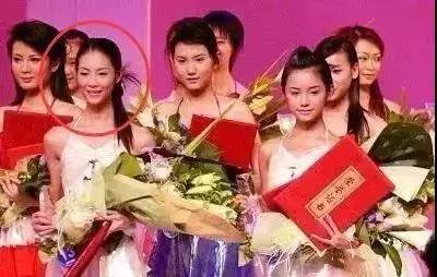 国际超模刘雯脸上的斑,超模脸刘雯