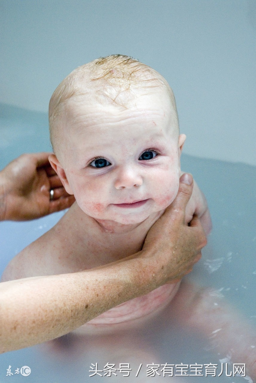 宝宝湿疹10个小妙招,宝宝湿疹怎么预防和处理