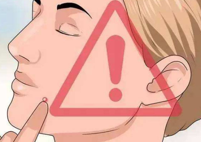 青春痘有什么方法解决,青春期已经长痘了怎么改善皮肤