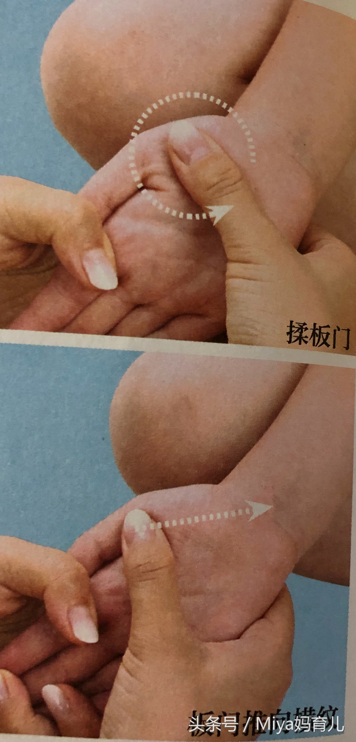 小儿推拿湿疹的调理,小儿推拿湿疹的正确手法视频