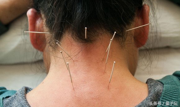 老年人三叉神经痛的最佳解决办法,mvd手术治疗三叉神经痛的标准