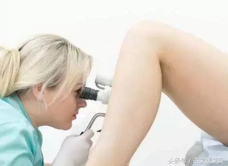 白带的颜色怎么样算是正常的,女性要注意观察白带的颜色