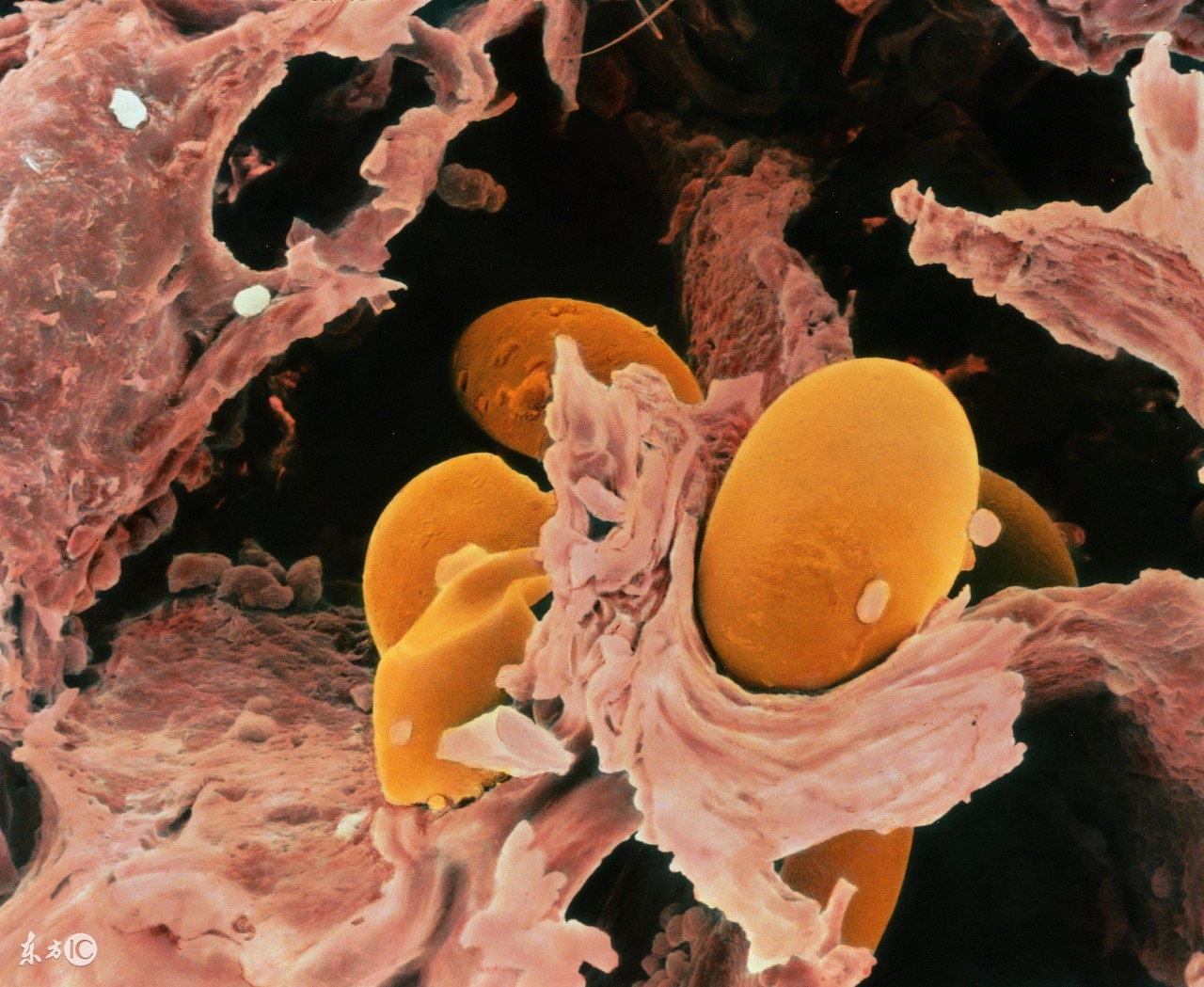 预防疥疮应采取以下措施,治疗疥疮最有效的方法