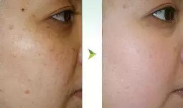 3块钱起，这牌子牛逼到，我一个月回购N次！