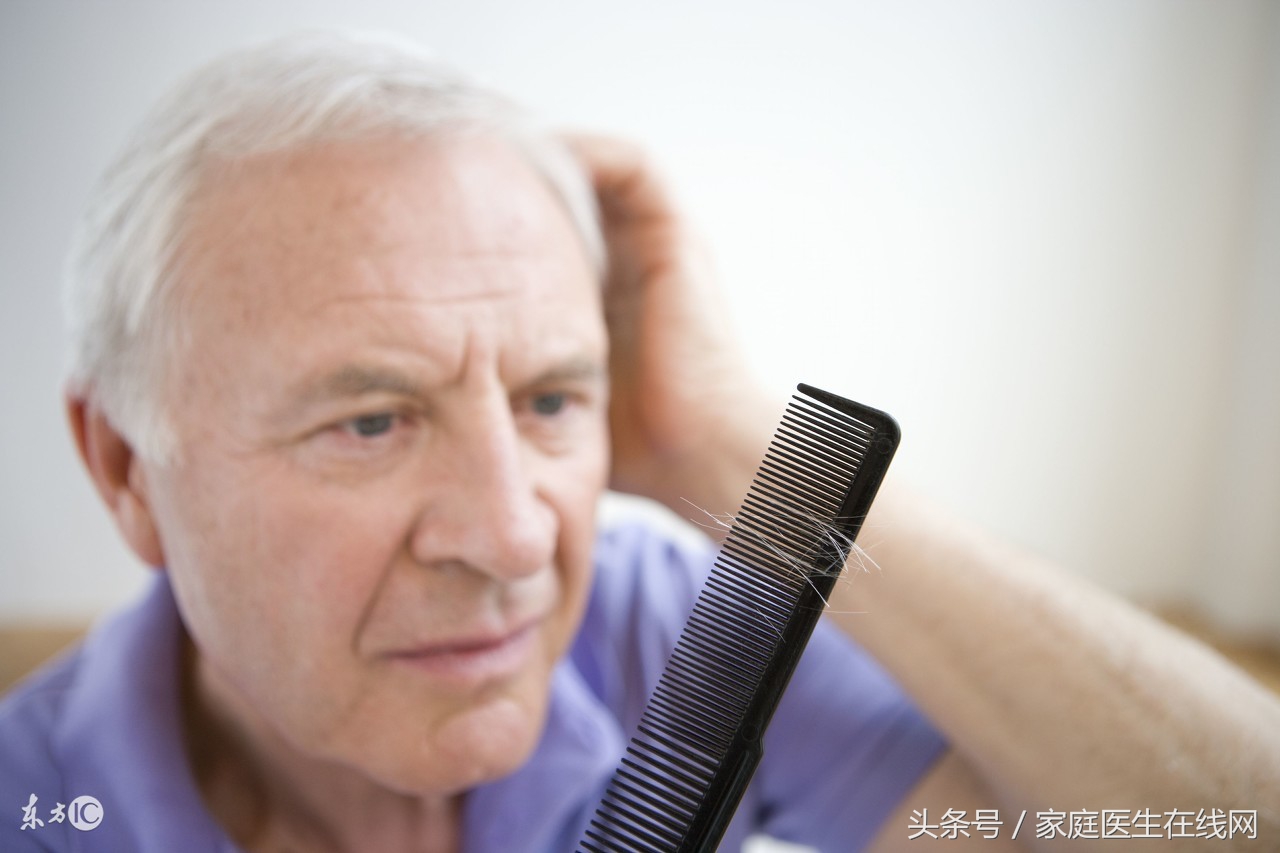 脱发的10个原因你有没有中招呢,5个因素