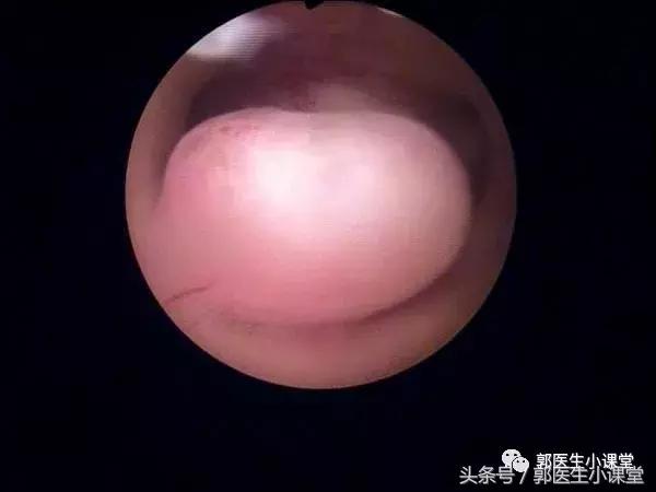 喝豆浆竟然会引起这个妇科病？