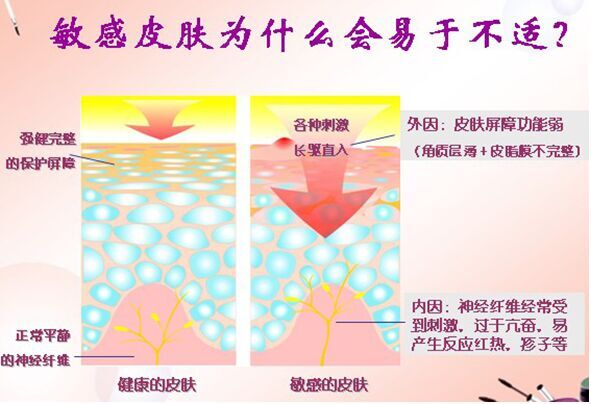 敏感肌肤为什么越补水越干,干性敏感肌肤怎么修复皮肤