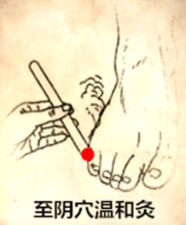 艾灸助孕多久见效,艾灸确实可以助孕但要注意方法