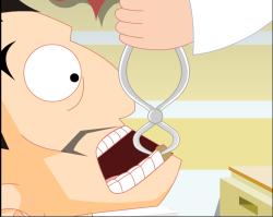 需要拔牙的标准,必须拔牙