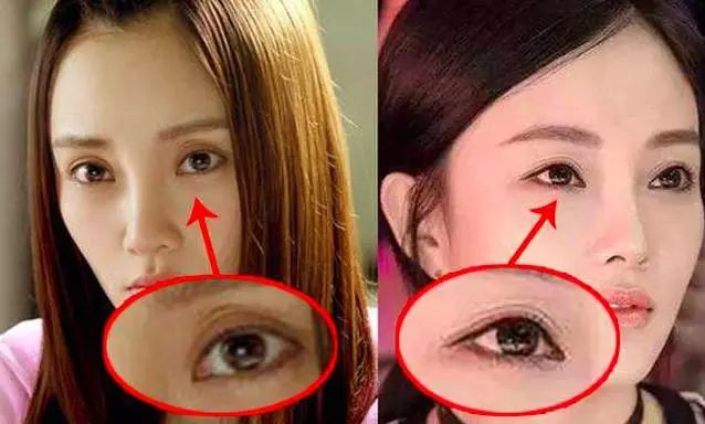 抗老眼霜大眼袋,抗老眼霜20-25岁黑眼圈