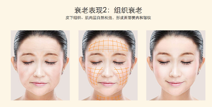 线雕的注意事项和方法,线雕提升讲解视频