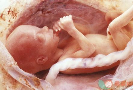怀孕33周，脐绕颈1周，孕期怎么做可以避免这种情况发生