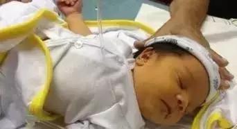 不要慌！新生宝宝这21种情况不是病！「爱贝佳月嫂讲堂」