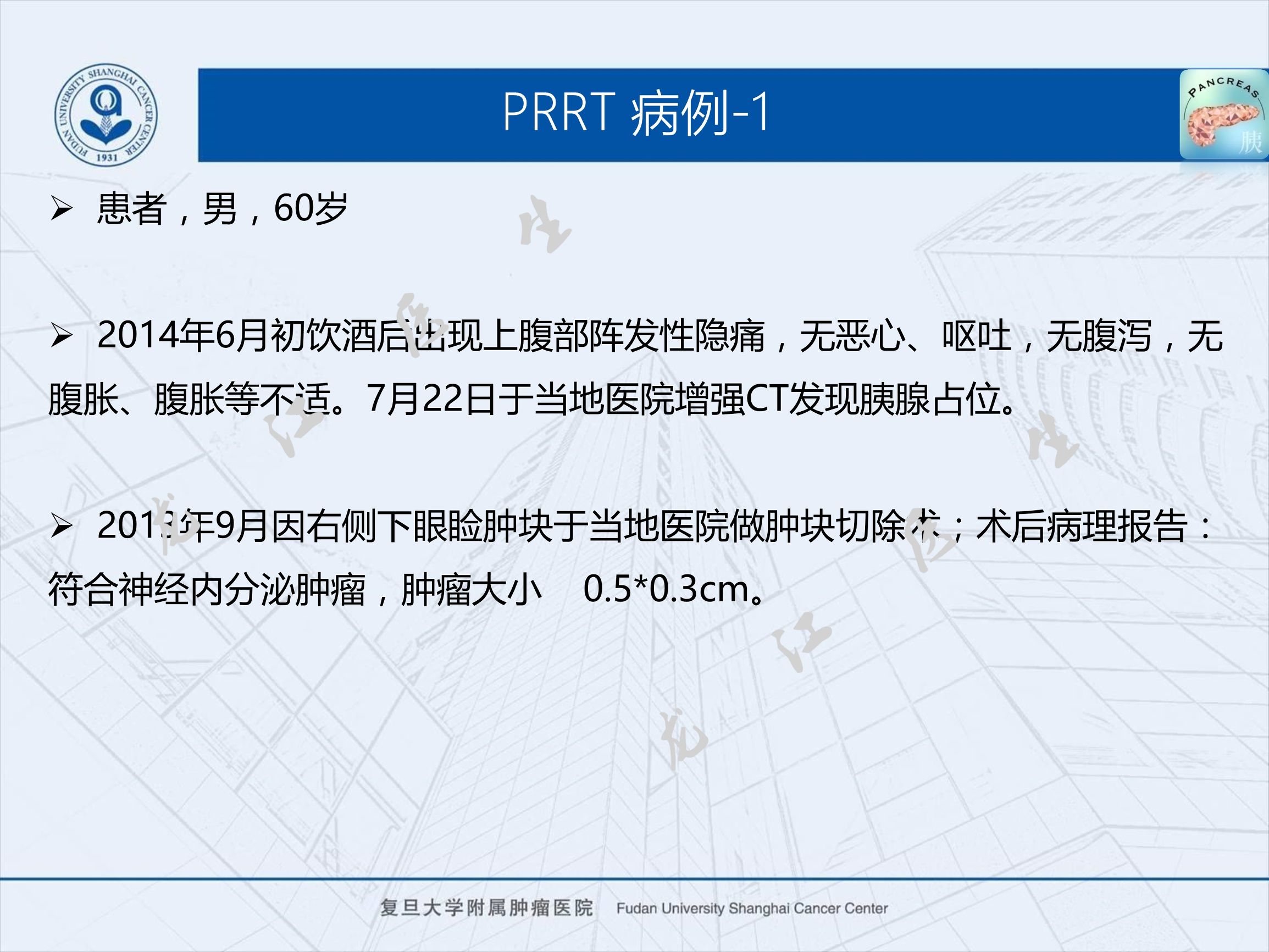 prrt治疗神经内分泌副作用,神经内分泌瘤ssrt