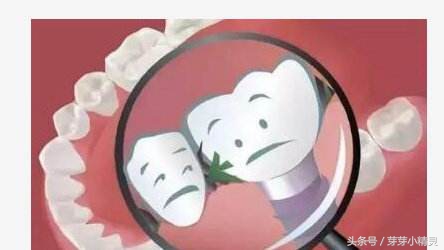 塞牙的原因和治疗方法,塞牙的罪魁祸首和危害你知道吗